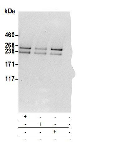 Neurofibromin 1 Antibody