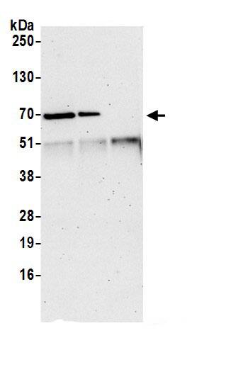 TBL2 Antibody