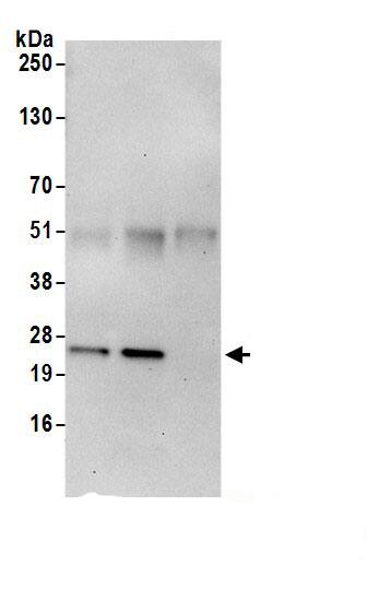 FAHD1 Antibody