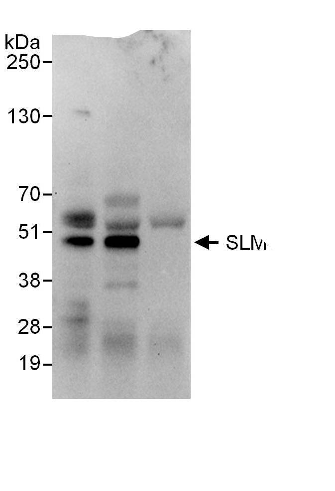 KHDRBS3 Antibody