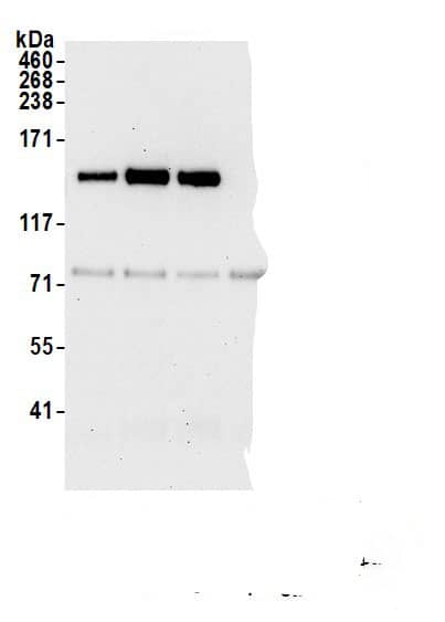 EZH2/KMT6 Antibody