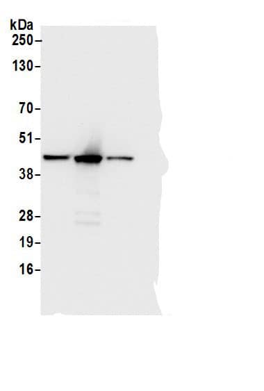 Adenosine Deaminase/ADA Antibody