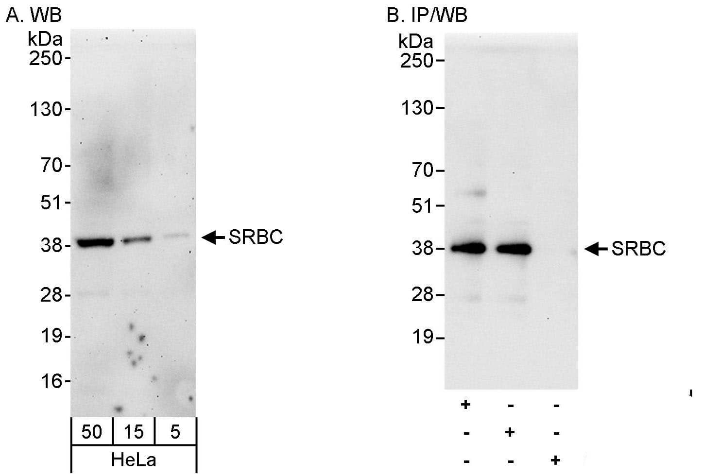 PRKCDBP Antibody