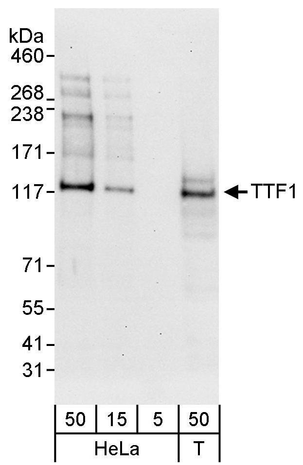 RNA polymerase I termination factor Antibody