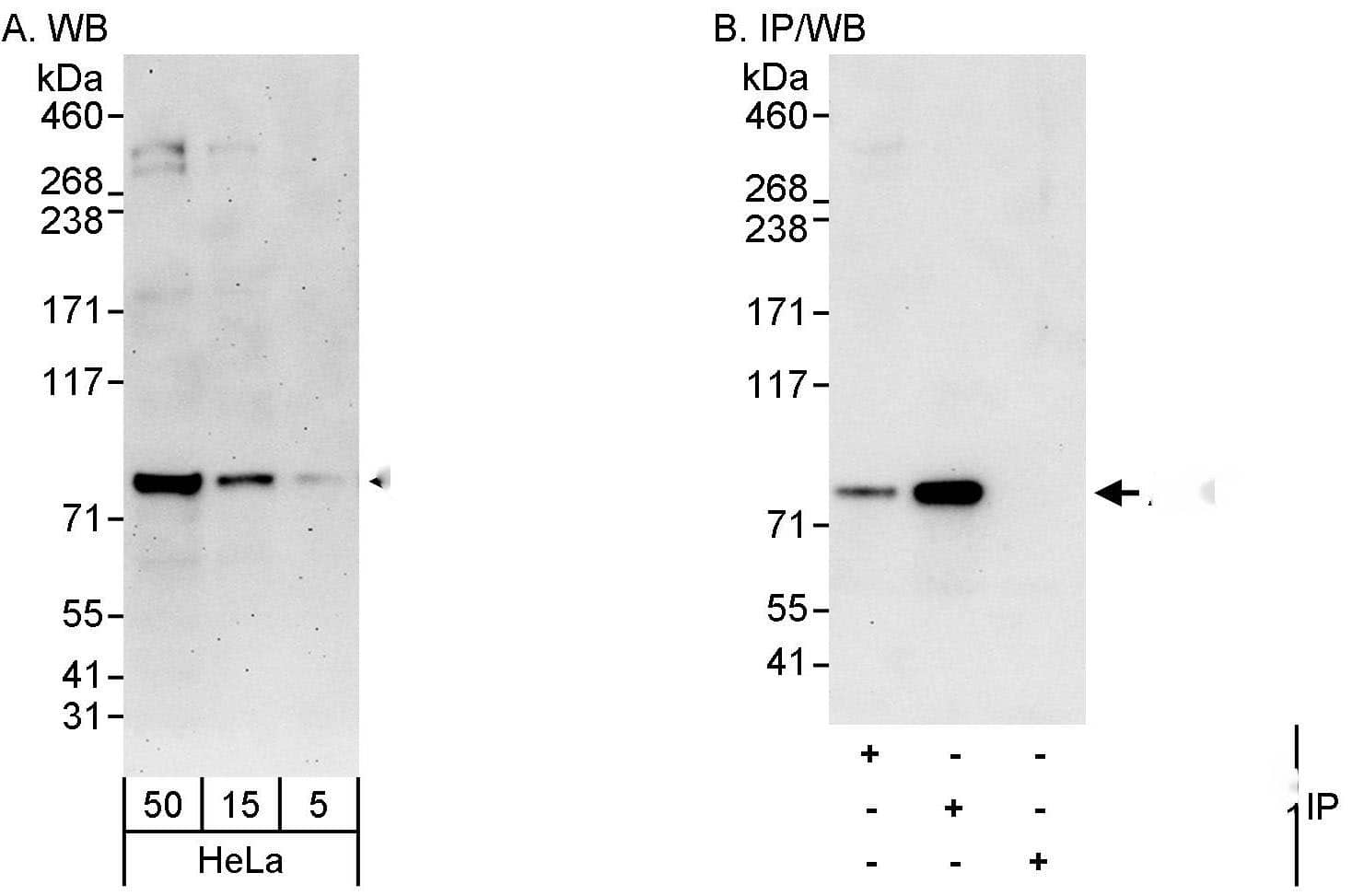 ABCF3 Antibody