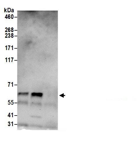 Thioredoxin Reductase 1/TRXR1 Antibody