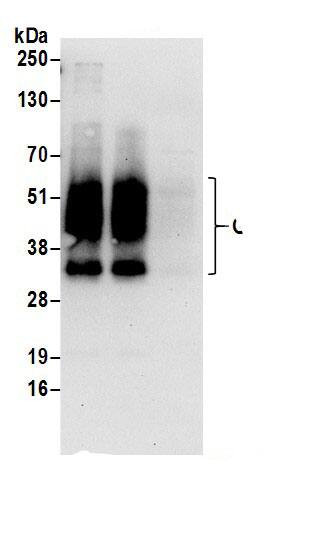 GPRC5A/RAI3 Antibody