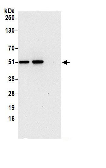 Cytosol Nonspecific Dipeptidase (CNDP2)/CPGL Antibody