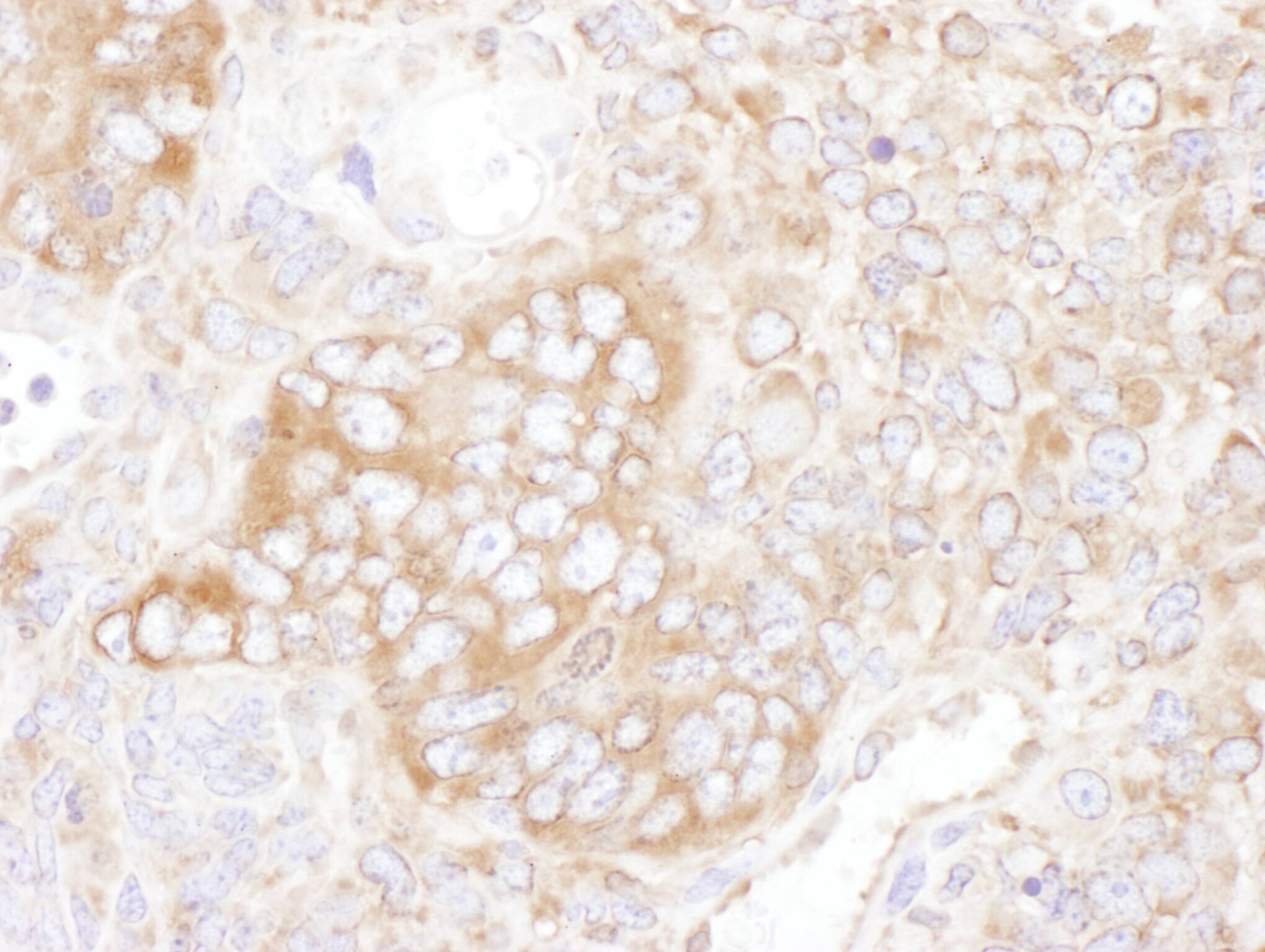 YB1 Antibody