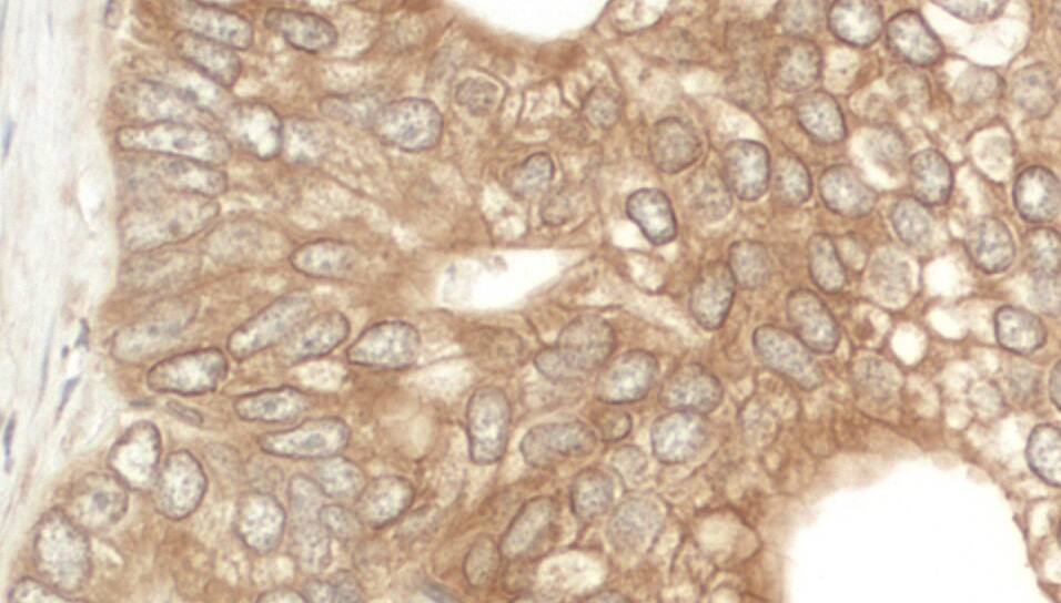NEDD4L Antibody