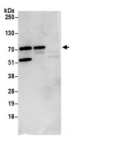 SLX4 Interacting Protein Antibody