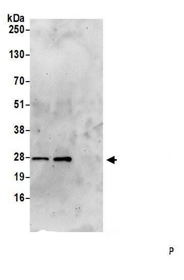 PRTFDC1 Antibody