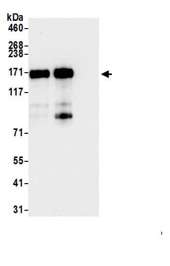 KDM6A Antibody