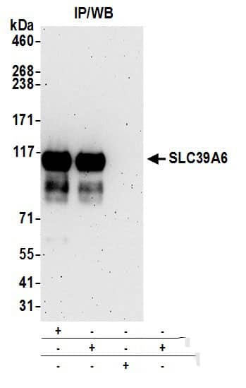 LIV-1/Zip6 Antibody