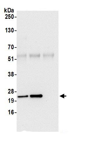 ATP5H Antibody