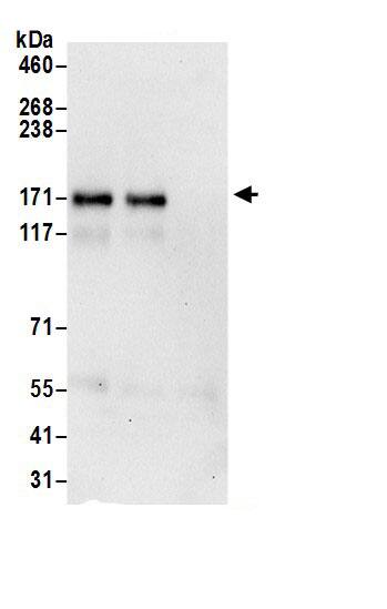 PTK7/CCK4 Antibody