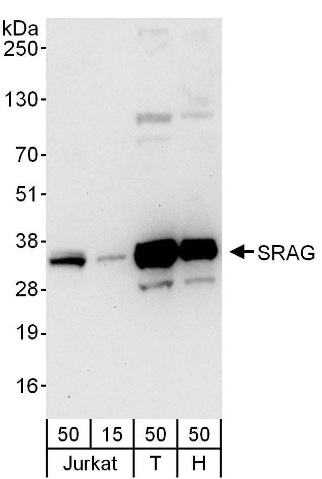 CHTOP Antibody