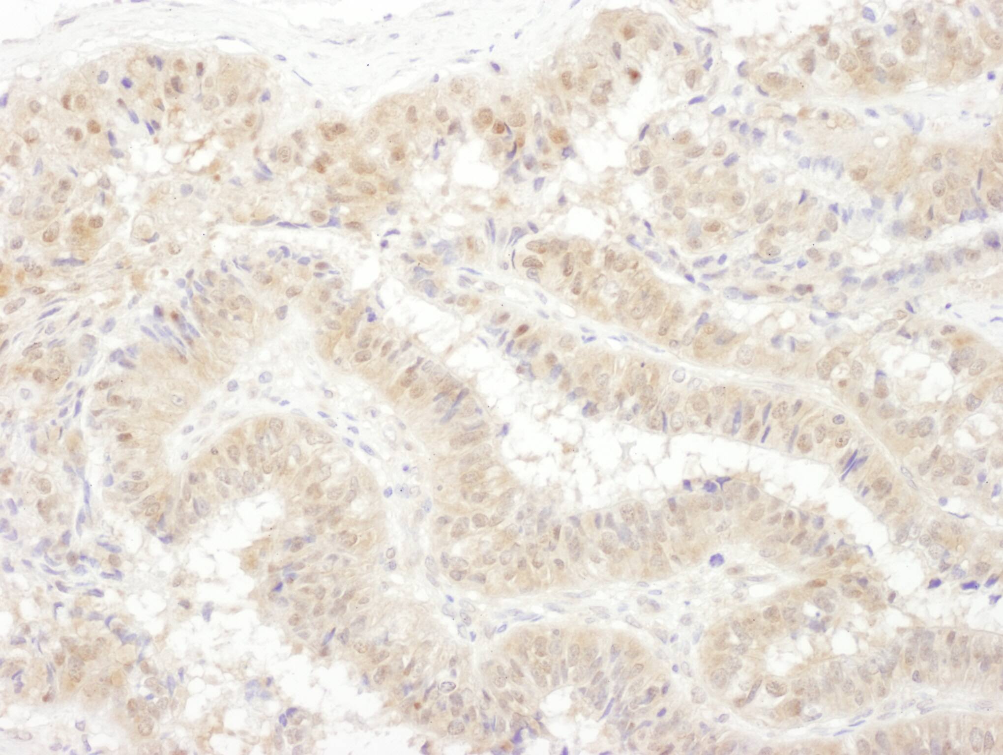 Tbp7 Antibody