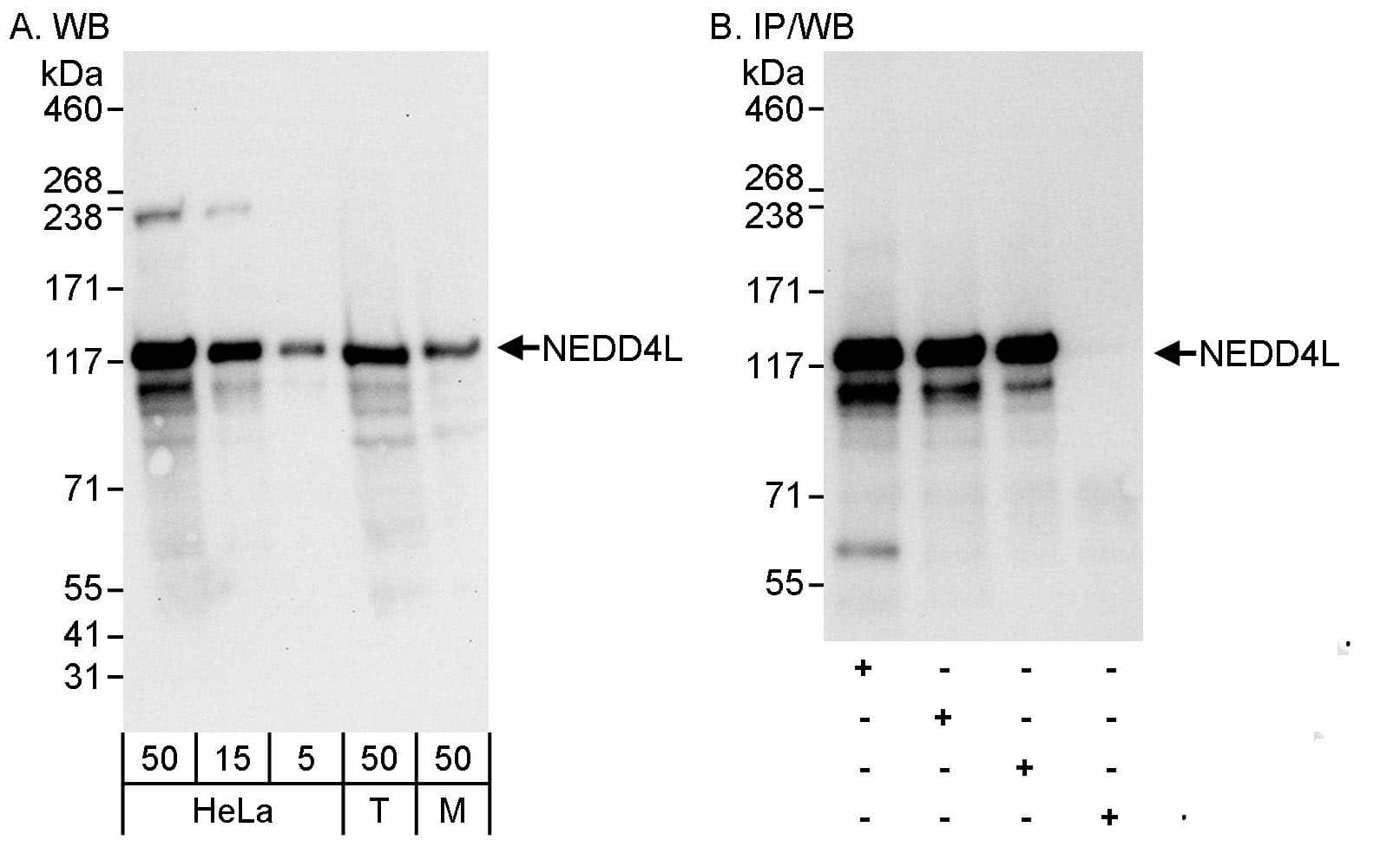 NEDD4L Antibody