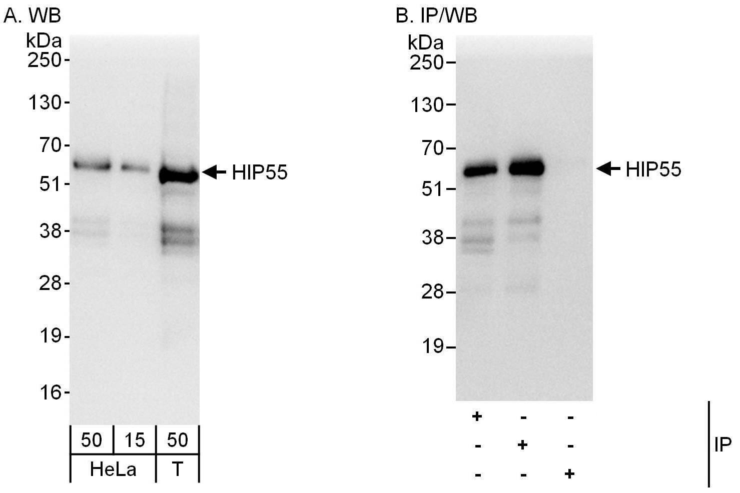 HIP-55 Antibody