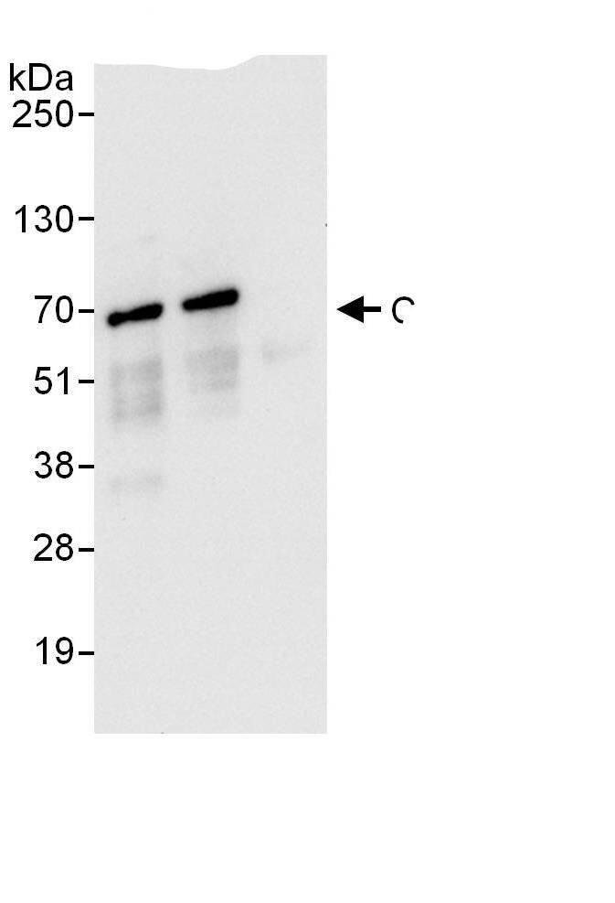 CARF/CDKN2AIP Antibody