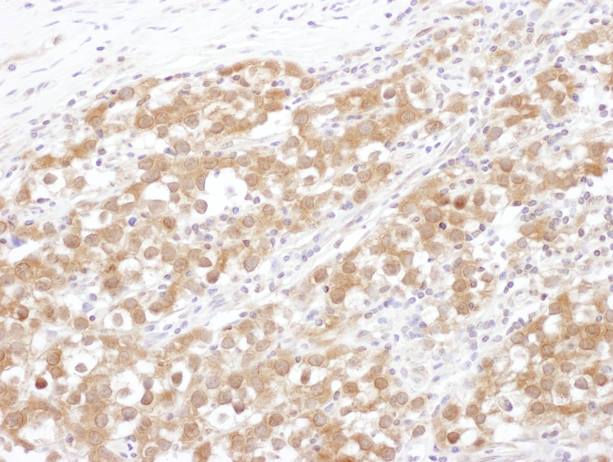 NUDC Antibody