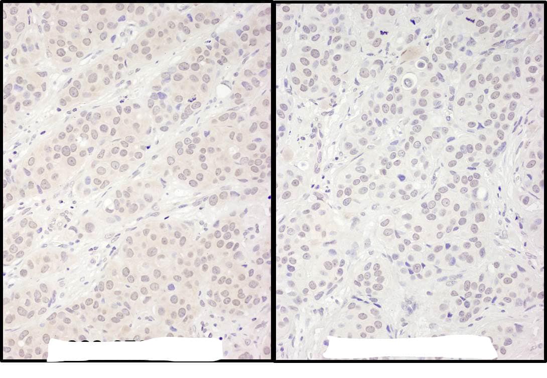 DDX56 Antibody