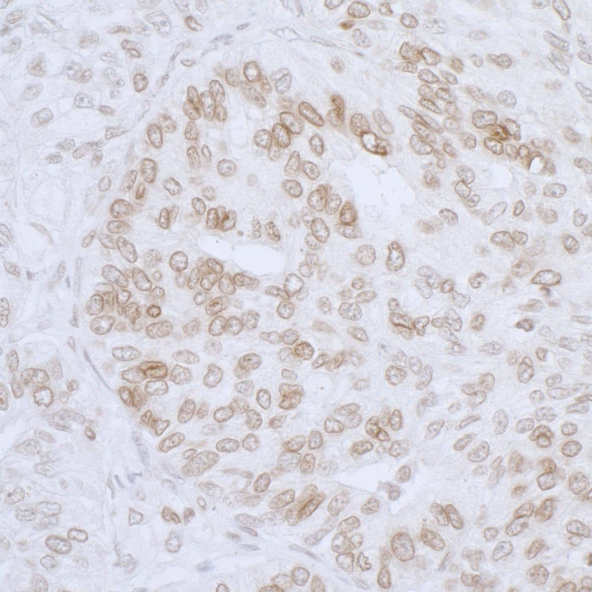 Thymopoietin/LAP2 Antibody