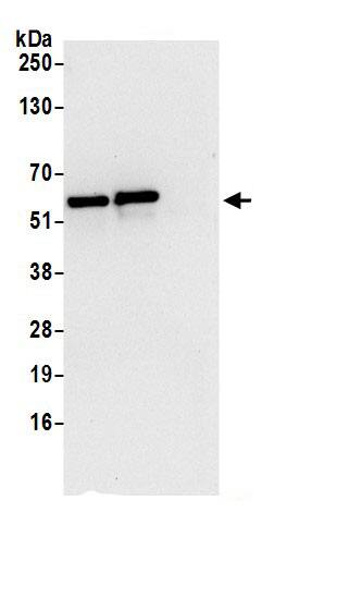 CCDC47 Antibody