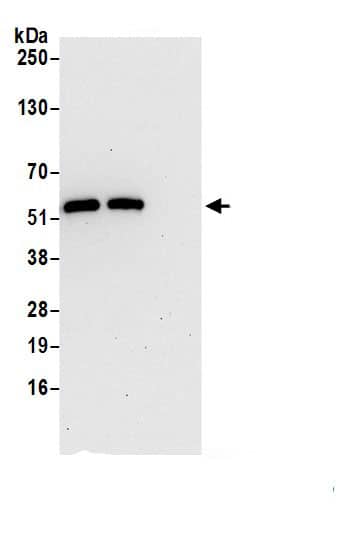 GSDMDC1 Antibody