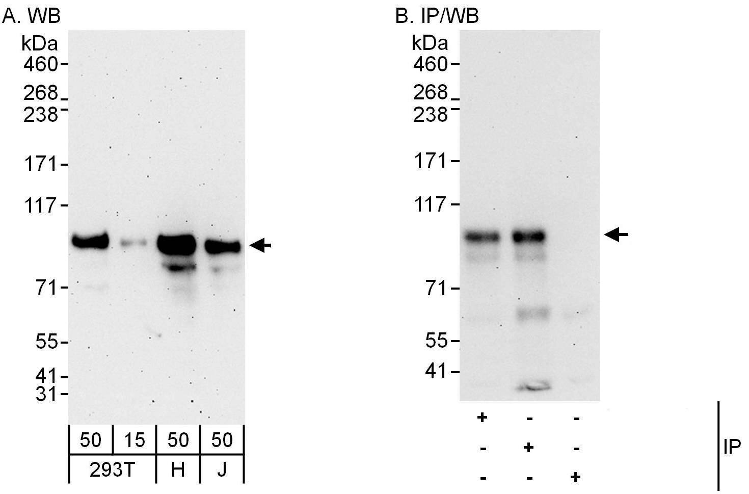 APBB2 Antibody