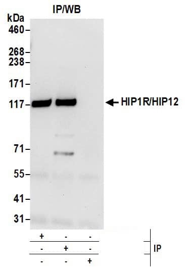 HIP1 Related Antibody
