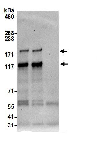 RALGAPB Antibody