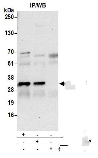 CAPZB Antibody