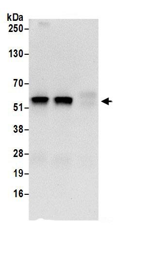 UDP glucose dehydrogenase Antibody