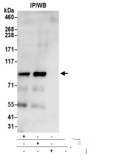 RHAMM/CD168 Antibody