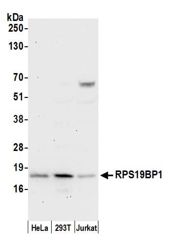 RPS19BP1 Antibody