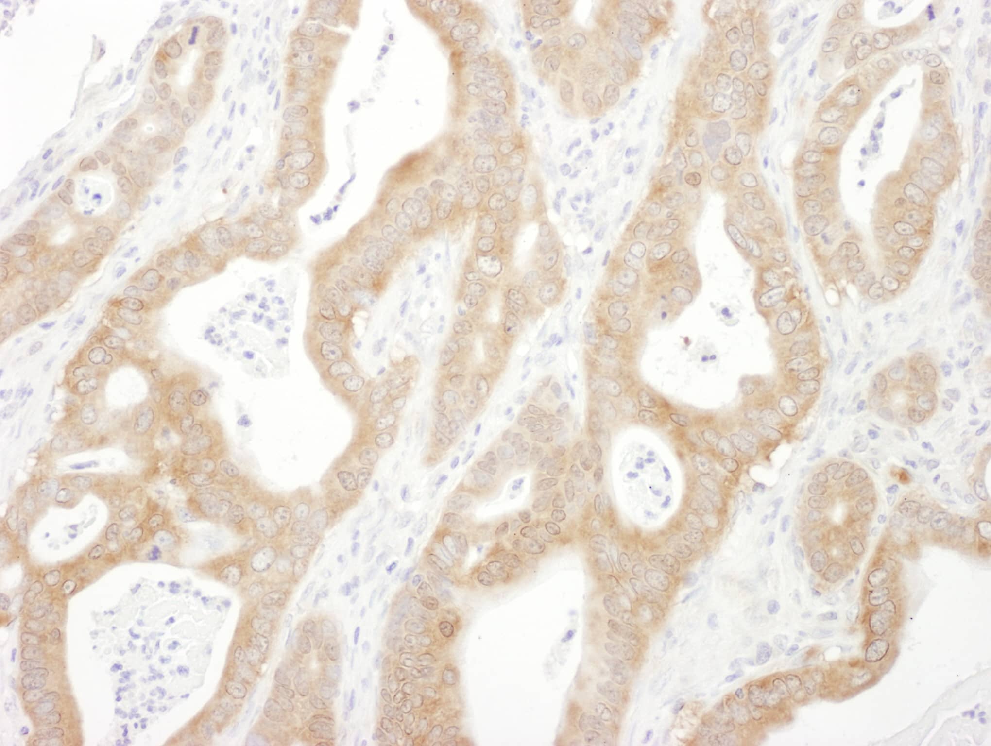 beta-Arrestin 1 Antibody