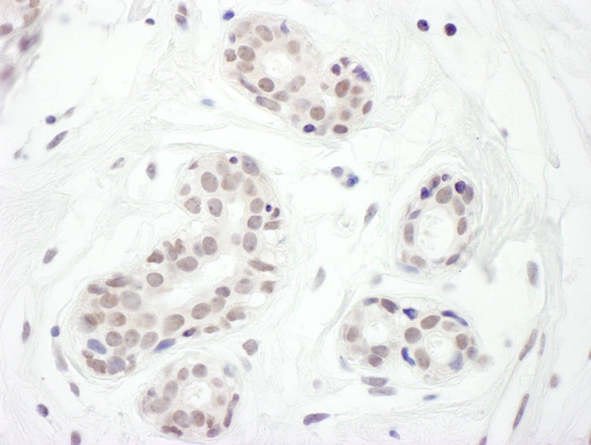 FoxC1 Antibody