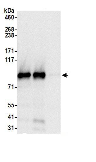 TBC1D5 Antibody