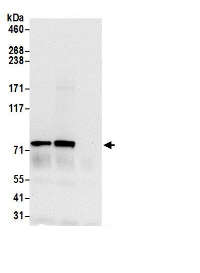 ALDH18A1 Antibody