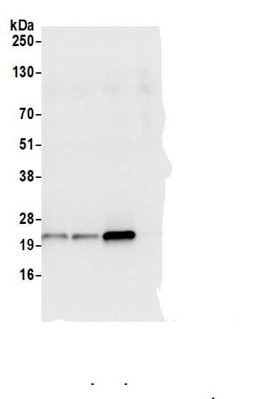 LMP7/PSMB8 Antibody