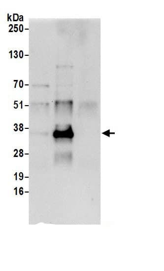 Dimethylarginine Dimethylaminohydrolase 1/DDAH1 Antibody