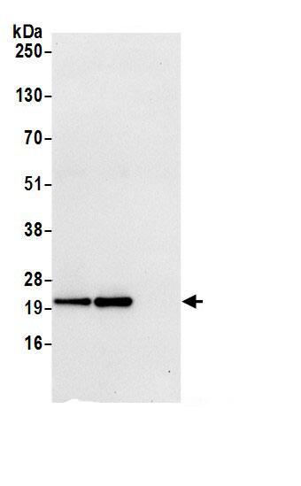 ATP5H Antibody