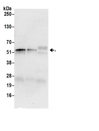 DARS Antibody