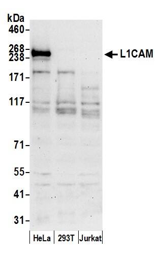 L1CAM Antibody