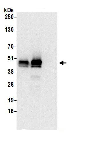 PDIA6 Antibody