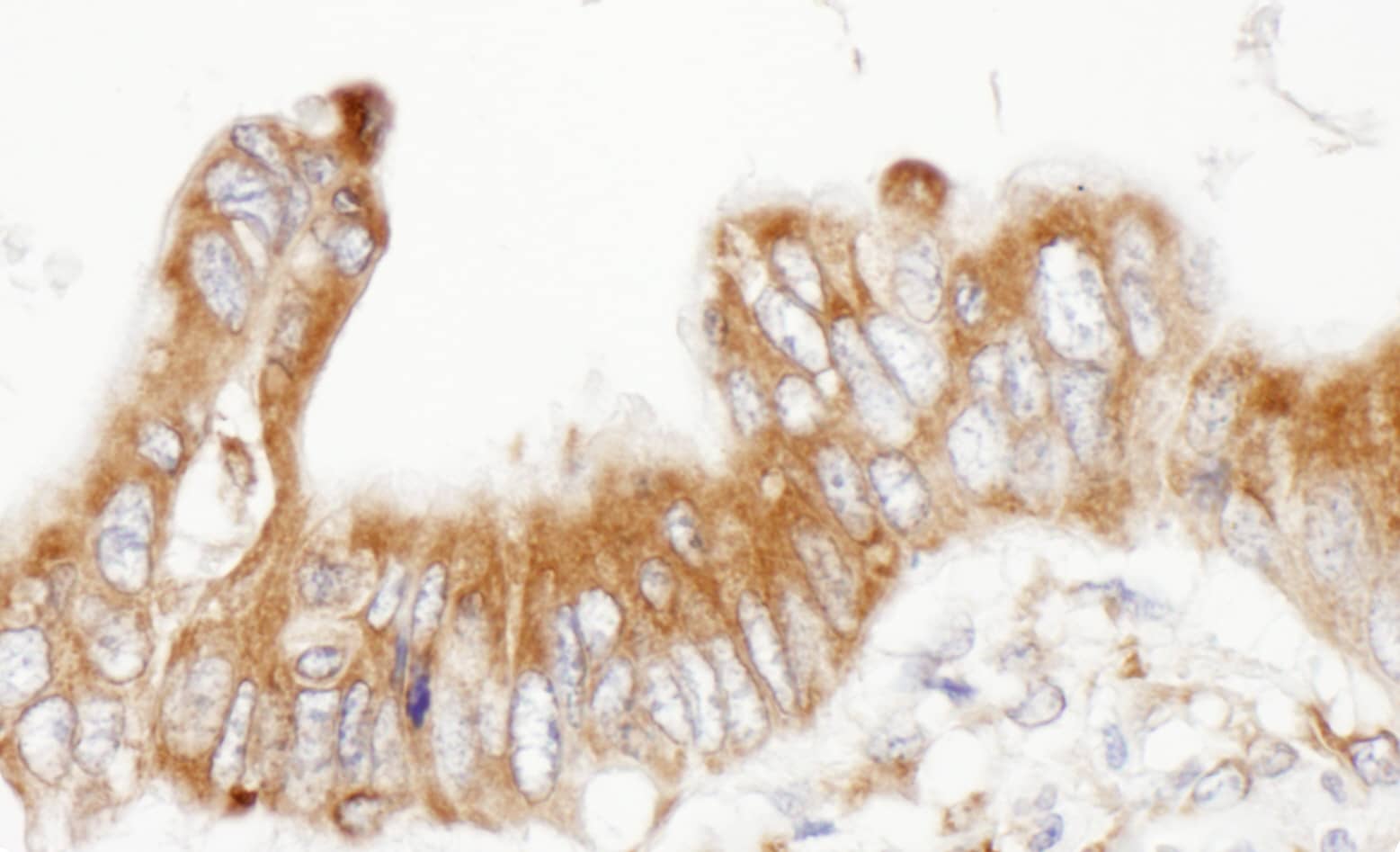 PDIA6 Antibody