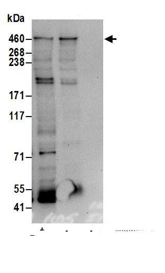 MGA Antibody