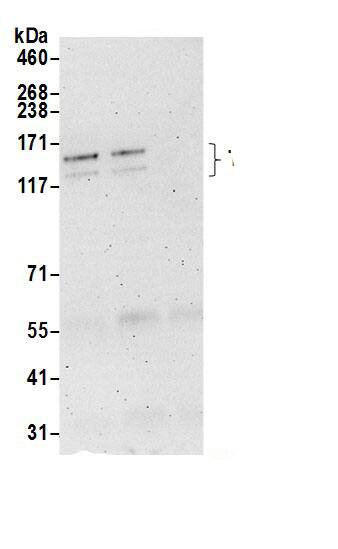 TBC1D1 Antibody